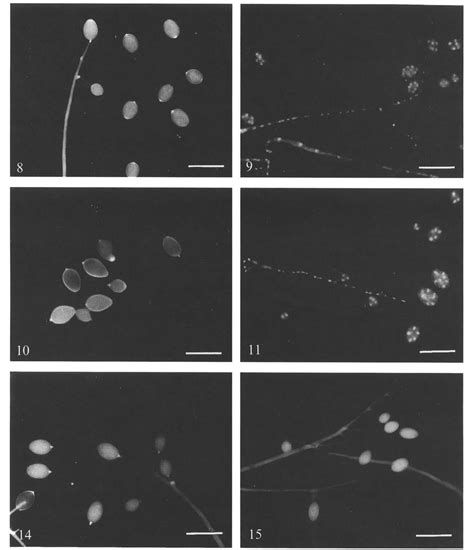 Sporangiogenesis In The Field Figs 8 9 12 H The Ovoid Sporangia