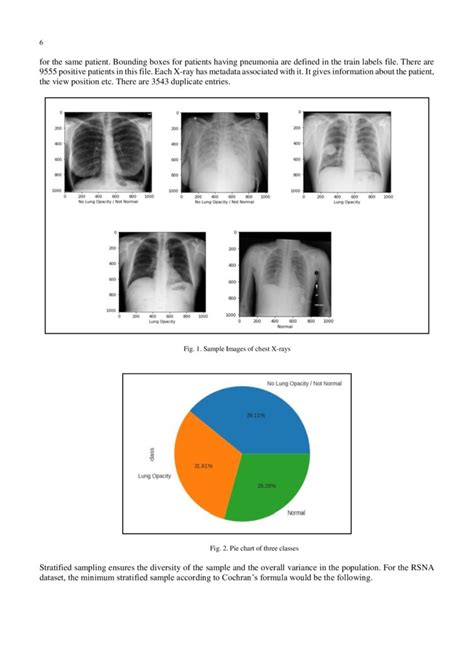 Pneumonia Detection In Chest X Rays Using Neural Networks Deepai