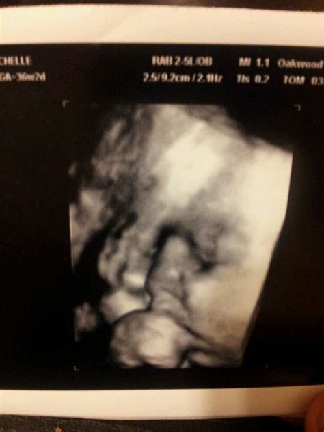 36 Week Ultra Sound Love What 4d Ultrasounds Can Do Ultrasound 4d