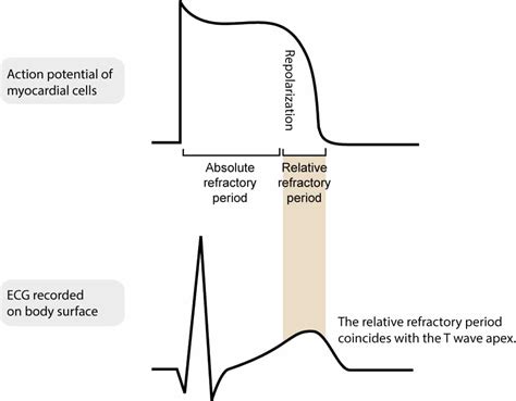 Effective And Relative Refractory Period