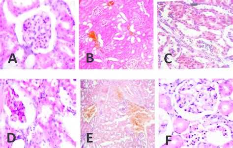 Photomicrograph Of Liver Sections Stained With H And E X400 A Control Download Scientific