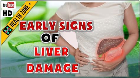 Early Signs Of Liver Damage Symptoms To Know Youtube