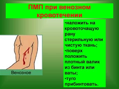 ПМП при кровотечении - презентация онлайн