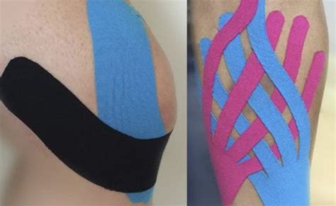 Kinesio Taping Professional Physical Therapy