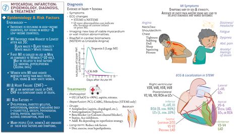 Usmle Comlex Step Myocardial Infarctions Symptoms Diagnosis