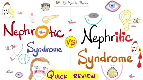 Nephrotic And Nephritic Syndrome Quick Review Nephrology