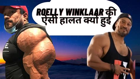 Side Effects Of Steroids ये क्या हो गया Roelly Winklaar को Before