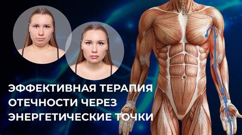 Отечность: методы лечения и профилактики - YouTube