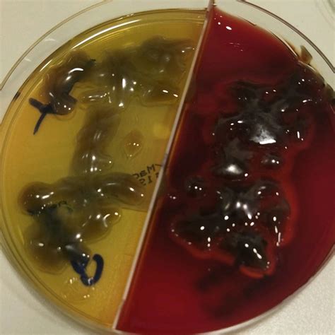 Uzmdrneriman T On Linkedin Pseudomonas Aeruginosa🦠 Urine Culture