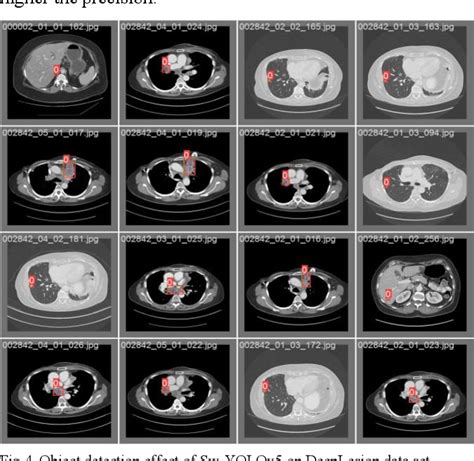 Table I From Research On Medical Image Object Detection Based On Swin