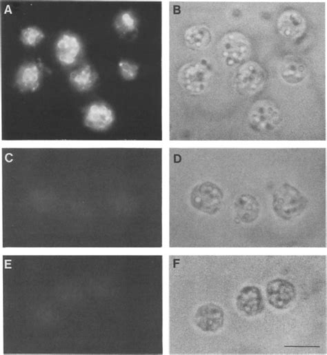 Accumulation Of Acridine Orange In Acidic Vacuoles In Vivo Cells Were