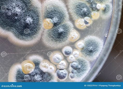 Different Shaped Colony Of Bacteria And Mold Growing On Agar Plates