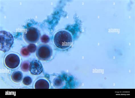 This Photomicrograph Of A Trichrome Stained Tissue Sample Revealed The Presence Of A Cyst Of A