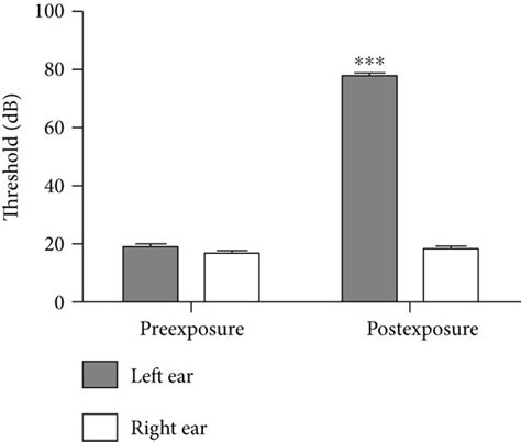 Auditory Brainstem Responses Before And After Noise Exposure A B Download Scientific