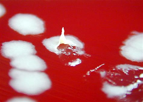 A Petri Dish Culture Plate Contained A Growth Medium Of Sheep Blood