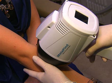 Melanoma Detection Device Melafind Raises Worries Among Dermatologists