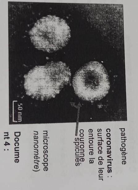 Calculer La Taille R Elle Du Virus Spicules Compris Partir De