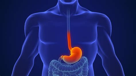 94 Inguinal Hernia Stock Video Footage 4k And Hd Video Clips