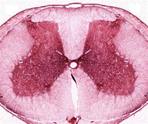 Microscopic Spinal Cord Anatomy Labeling Practice Spinal Cord Diagram