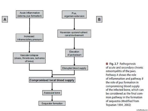 Osteomyelitis Pptx داسماء Muhadharaty