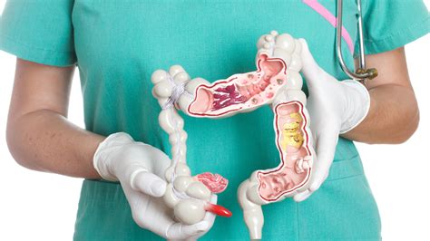 Descubren Vínculos Entre El Síndrome De Intestino Irritable Y Trastornos De Salud Mental Infobae