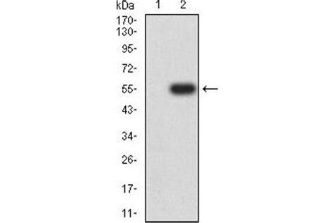 Sox11 Antibodies