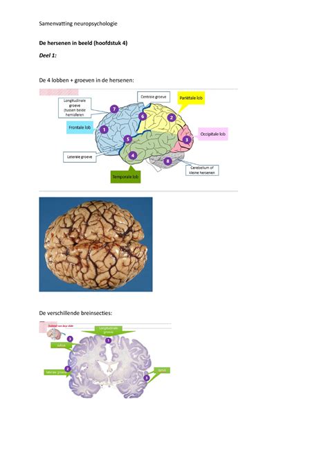 Samenvatting Hoofdstuk Deels De Hersenen In Beeld Hoofdstuk