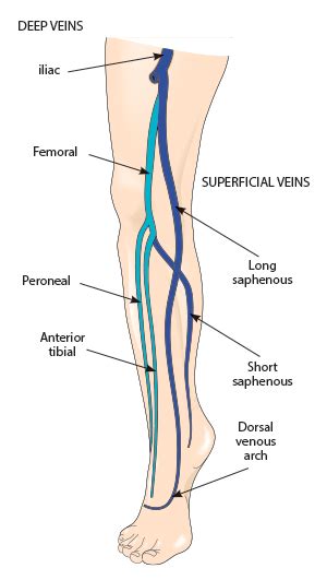 Superficial Can Also Be Deep Superficial Thrombophlebitis Department Of Emergency Medicine