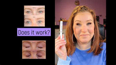 The Ordinary Lash And Brow Serum Review Before And After Photos Youtube