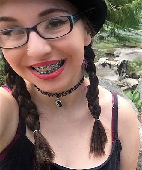 Pin On Glasses And Braces