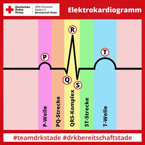 Aufzeichnung Eines Elektrokardiogramms Ekg Drk Bereitschaft Stade