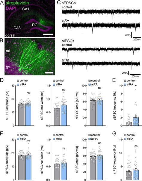 Figures And Data In All Trans Retinoic Acid Induces Synaptopodin