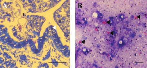 Localization Of M Ulcerans In 5 M Sections Of Tissue From Infected