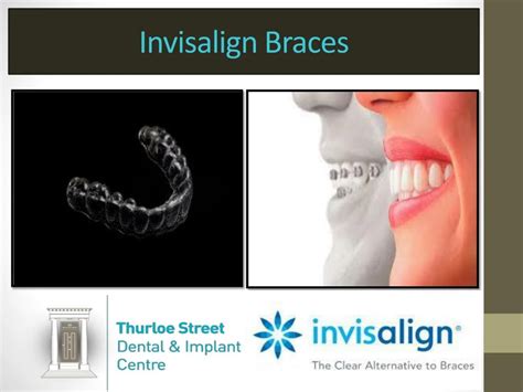 Ppt Invisalign Braces Powerpoint Presentation Free Download Id 8052822