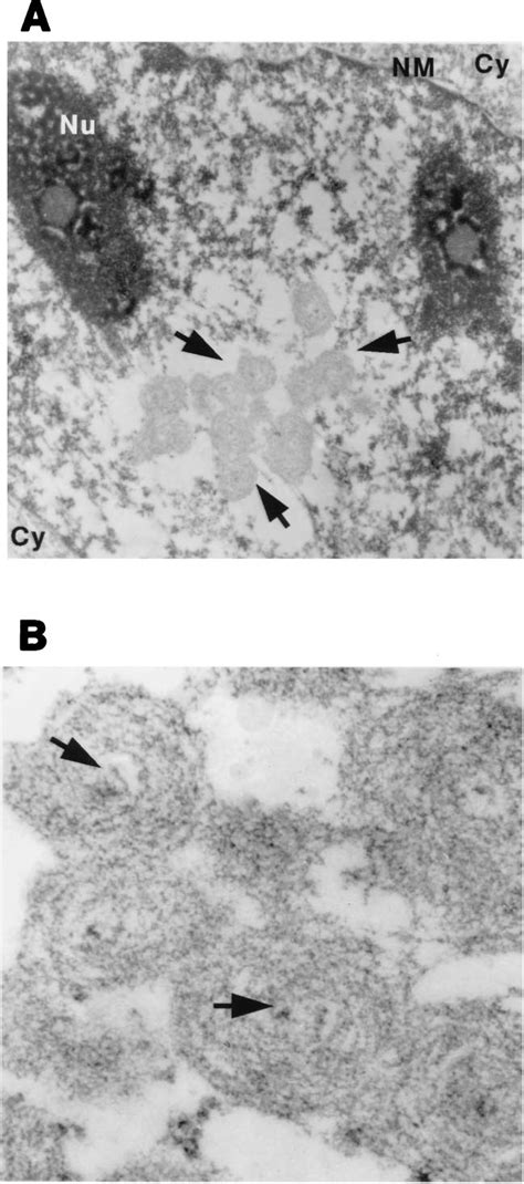 Electron Microscopic Analysis Of Arsenic Treated Cells A Low