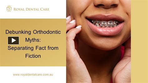 Ppt Debunking Orthodontic Myths Separating Fact From Fiction