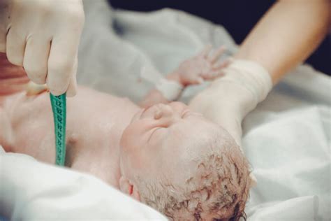 Tests For Your Baby After Theyre Born Birth In Grampian