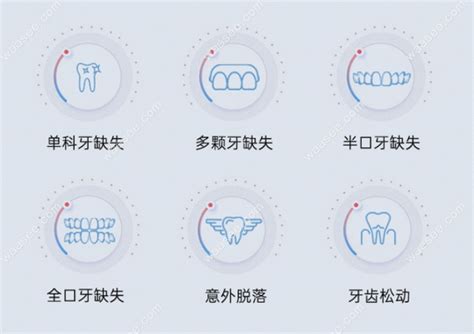 成都中诺口腔种植牙价格表种一颗牙 半口 全口收费有补贴 口腔资讯 牙齿矫正网