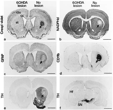 Dopamine Modulates The Susceptibility Of Striatal Neurons To