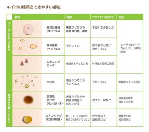 意図 誕生日 マダム 石 いぼ プール 変化する 残基 影