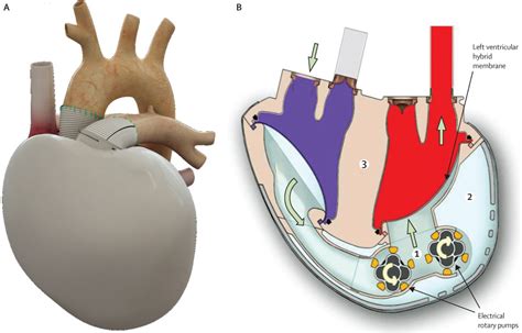 Artificial Heart Diagram