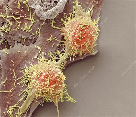 Natural Killer Cells And Cancer Cell Sem Stock Image C