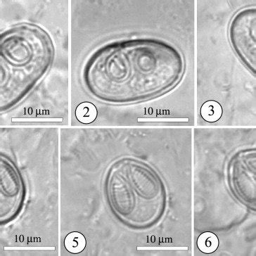 Light Micrographs Of Fresh Mature Spores Of Myxobolus Brachysporus