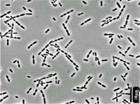 Ruminococcus - microbewiki