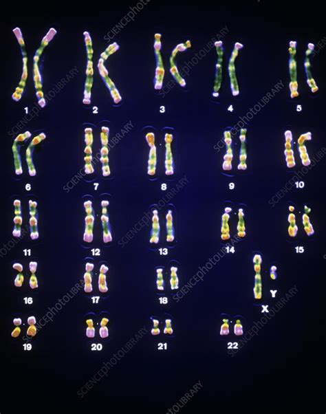 False Colour LM Of A Set Of Male Chromosomes Stock Image P656 0009