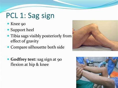 Knee Examination