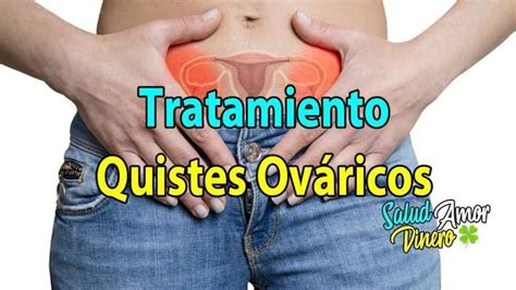 Tratamiento Natural Para Los Quistes Ováricos Ovarios Poliquisticos