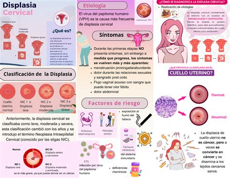 Triptico De Displasia Cervical Del Sistema Inmunitario La Displasia