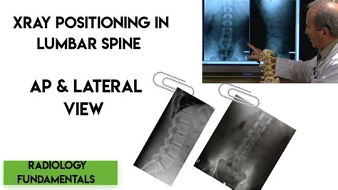 X Ray Lumbar Spine Ap Lat Position X Ray Lumbar Spine Lumbar Spine X Ray ~ Enjeela Shafat