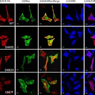 Comparison Of Intracellular Localization Of Ldlr Wildtype And Mutant